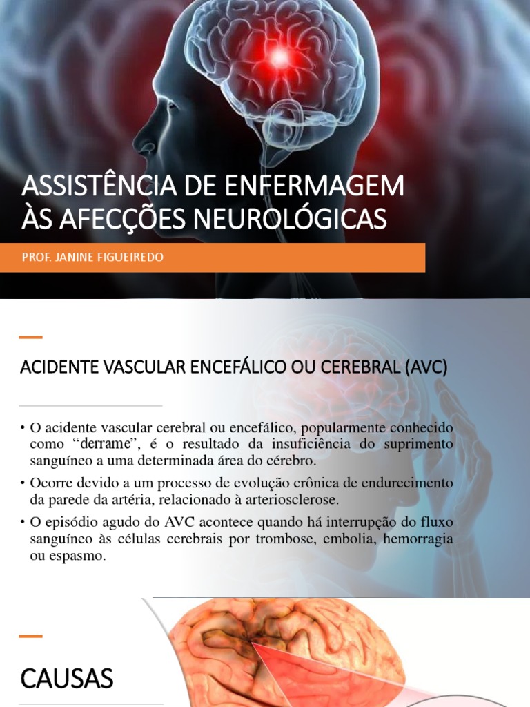 2 Assistência de Enfermagem Às Afecções Neurológicas | PDF | AVC ...