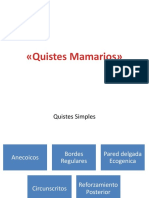 Quistes Mamarios