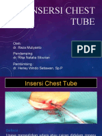 Chest Tube