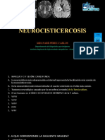 Neurocisticercosis: Mr1 Paré Pérez Carlos