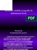 Anomalii abdomenale fetale