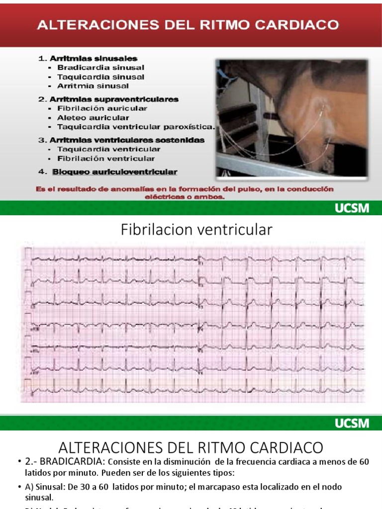 ritmo cardiaco de un niño de 5 años
