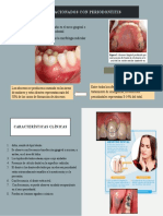 Abscesos No Relacionados Con Periodontitis