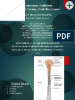 Radiologi Tumor Tulang