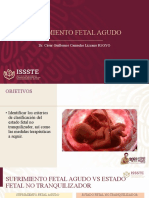 Sufrimiento Fetal Agudo