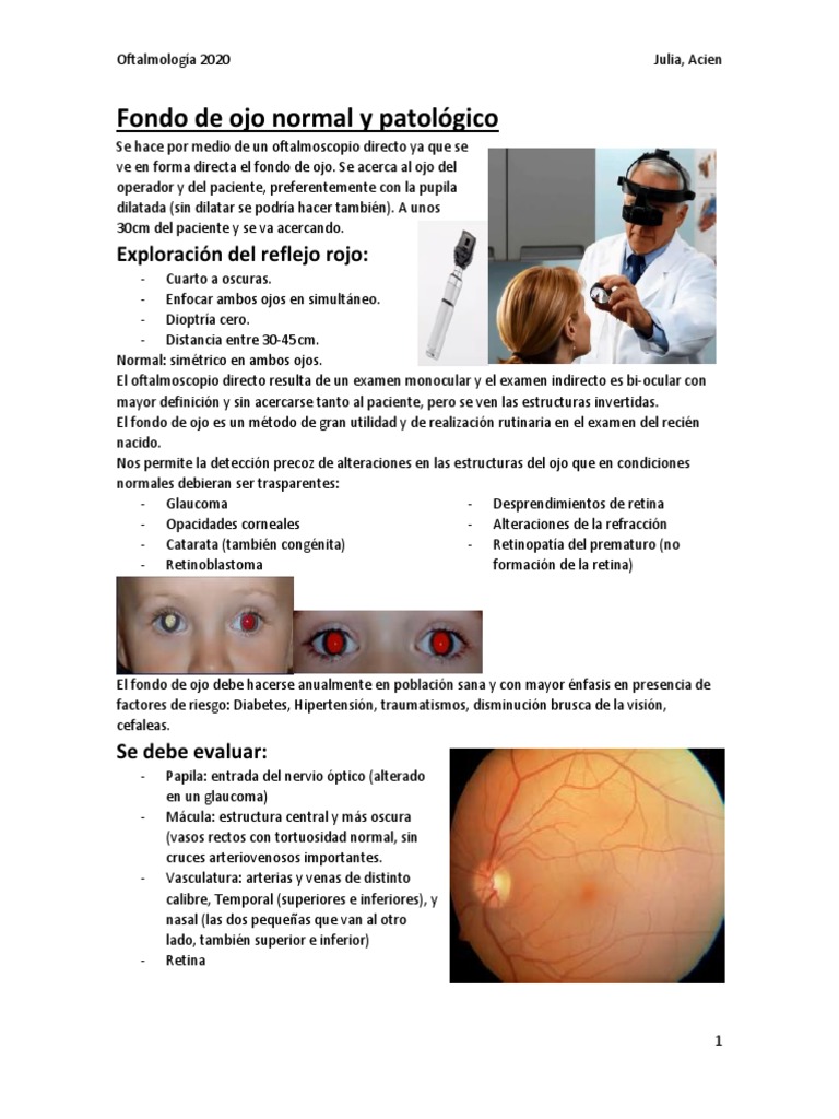 Examen de Fondo de Ojo Normal y Patológico | PDF | Ojo humano ...