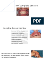 Insertion of Complete Denture