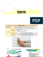 Edema: causas, tipos y mecanismos generales