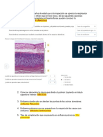 Faringeas:: Cor Pulmonale