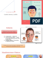 Sinusitis, Faringoamigdalitis y Laringotraqueitis