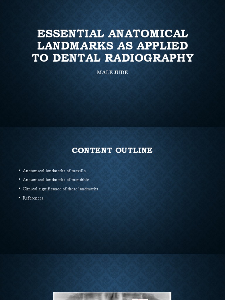Essential Anatomical Landmarks As Applied To Dental Radiography PDF