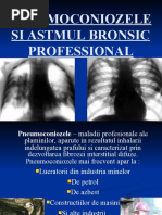pneumoconioze-73920