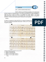 Electrocardiograma Choca 123 142