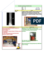 FAS HSE Alert AMS 31258 Leg Fracture