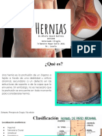 Hernias