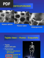 Download Osteoporosis by Antero Vasquez Mejia SN6201323 doc pdf