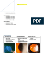 Clasificación de Distrofias Corneales