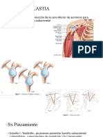 Acromioplastia