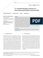 Brugada Phenocopy or Congenital Brugada Syndrome Pericarditid