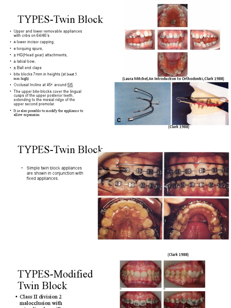 Types of Twin Block Appliances | PDF | Orthodontics | Dentistry Branches