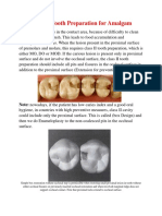 Class II Tooth Preparation For Amalgam