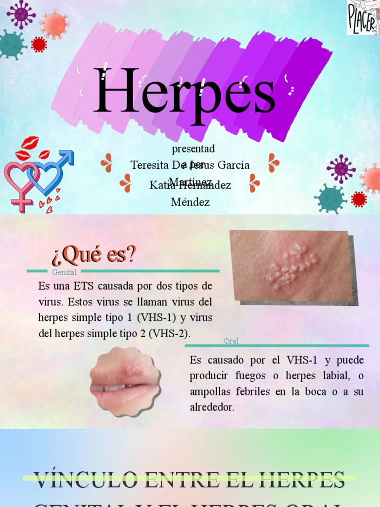 S ntomas Y Tratamiento Del Herpes Genital PDF Herpes Simple 