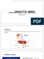 Meningitis (Mri)