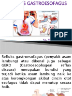 Refluks Gastroesofagus