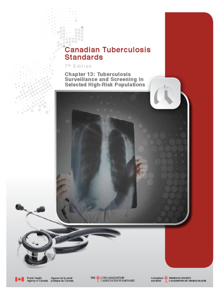TB Standards TB Normes Ch13 Eng PDF Tuberculosis Screening (Medicine)