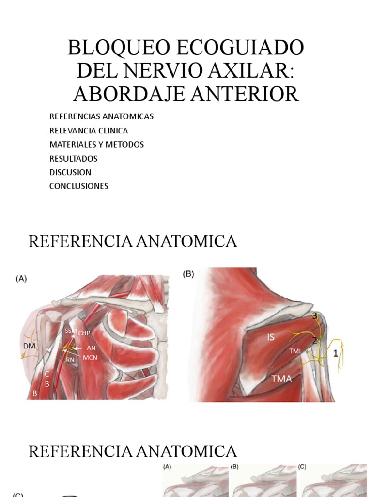 bloqueo-axilar-ecoguiado-anterior-pdf-tecnolog-a