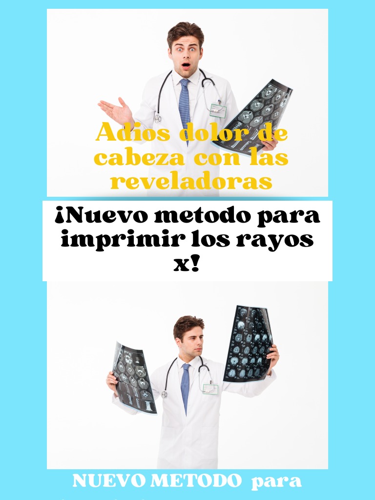¡Nuevo Metodo para Imprimir Las Rayos X! | PDF