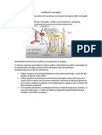 Insuficiencia renal aguda: causas, clasificación y tratamiento