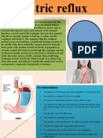 Gastric Reflux