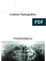 Análisis RX Panorámica