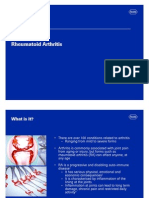 Rheumatoid Arthritis