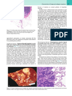 Hematogenous Spread. Lymphatic Spread.: 275 Characteristics of Benign and Malignant Neoplasms