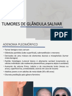 Tumores de Glândula Salivar
