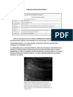 Embarazo Intrauterino Normal