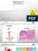 Esofagitis Por Cuastico