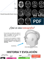 Tomografia Axial Computarizada: Brenda Esmeralda Huerta Guerrero