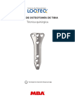 Placa de Osteotomia Tibia