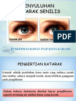 Penyuluhan Katarak