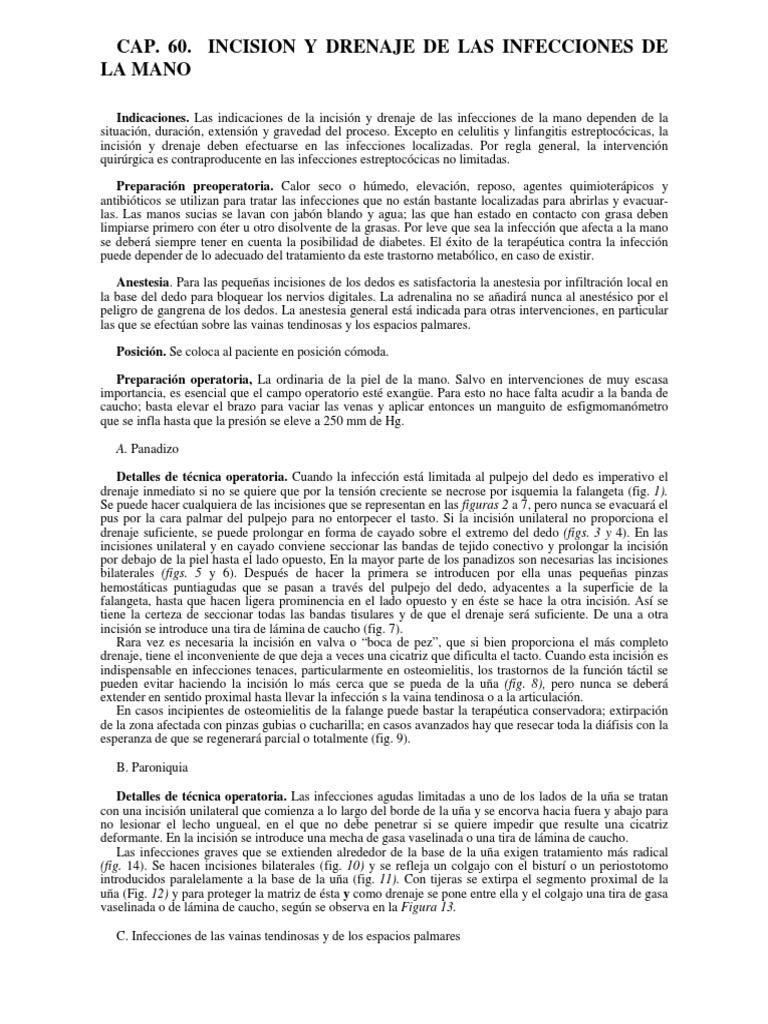 Incisión y Drenaje de Infecciones en la Mano | PDF | Sistema ...
