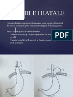 4. Hernii hiatale