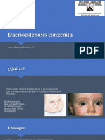 Dacrioestenosis Congenita