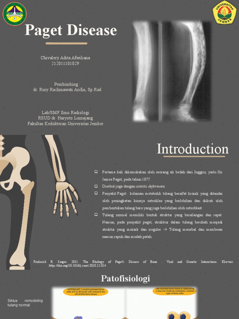 Presentasi Paget Disease | PDF