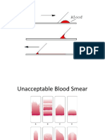 Bloos Smear Methods