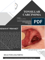 Tonsillar Carcinoma