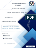 Informe TC Grupo 14 Columna