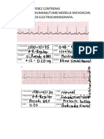 Kiara Andrea Perez Contreras Lic. Nutricion Humana/Tumb Morelia Michoacan. Tarea: Ejercicios Electrocardiografia